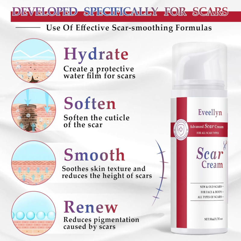 Advanced Stretch Mark, Keloid Bump, C-Section & Scar Removal Cream - Image 3