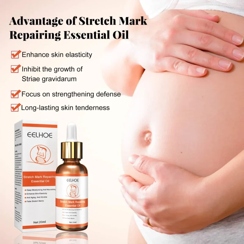 Stretch Marks Remover Essential Oil - Image 4