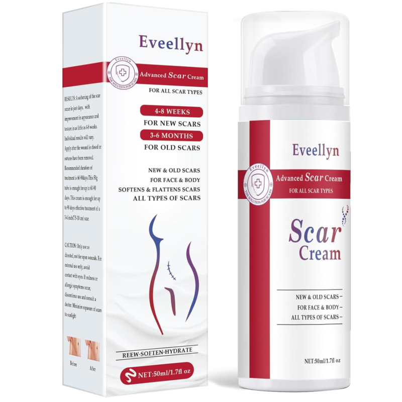 Advanced Stretch Mark, Keloid Bump, C-Section & Scar Removal Cream